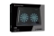CONCEPTRONIC 2-Fan USB-A2.0 Laptop-Kühlpad 3Kg 15.6 sw