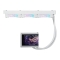 Asus WAK ROG RYUO IV 360 ARGB WHT